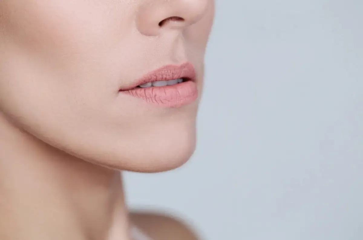Ilustrasi, bibir kering atau bibir pecah pecah