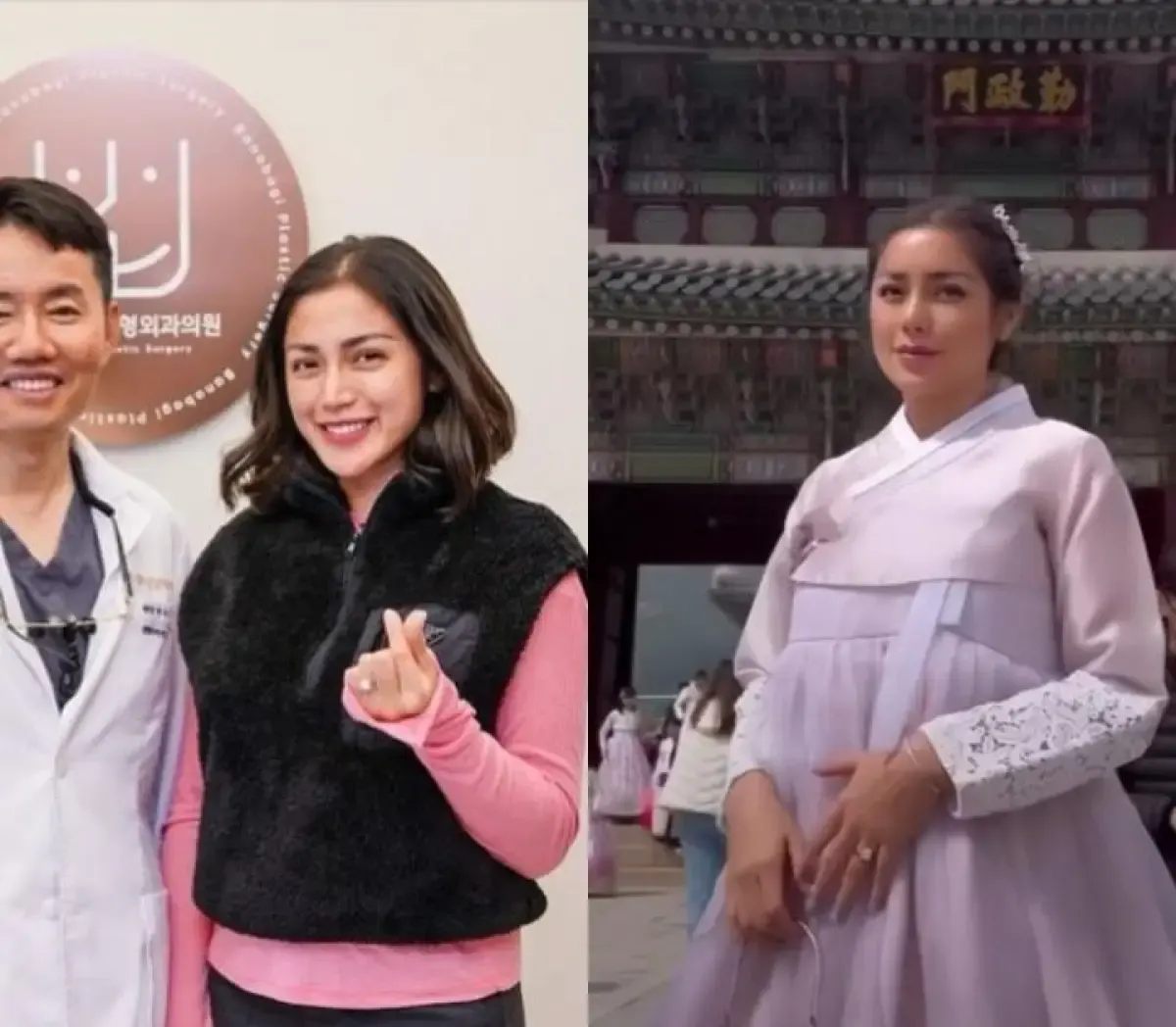 Operasi Pastik Hidung Jessica Iskandar (Sumber: Instagram.com/inijedar/)