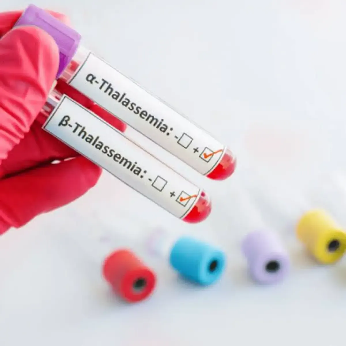 Thalasemia (Freepik.com/)