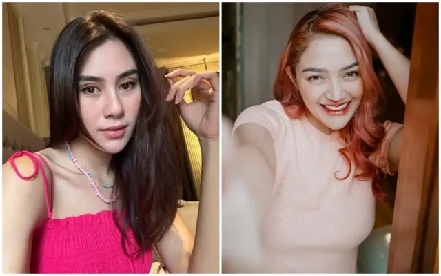 7 Artis Pernah Disangka Operasi Plastik, Ada Perubahan di Wajahnya