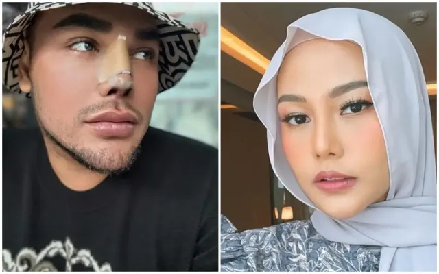 7 Artis Indonesia Melakukan Operasi Hidung, Bikin Pangling!