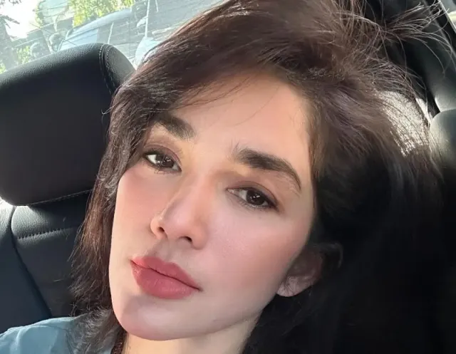 Intip Perawatan Kecantikan ala Ussy Sulistiawaty: Aku Nggak Filler, Cuma Botox