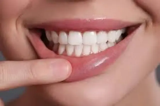 Ternyata Kebiasaan Ini Bikin Gigi Menguning