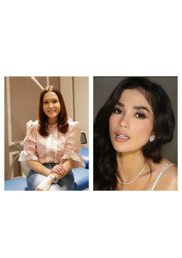 7 Artis Makin Tirus dan Mancung Berkat Tanam Benang