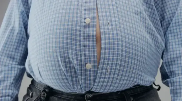 Apa Bedanya Gemuk dan Obesitas?