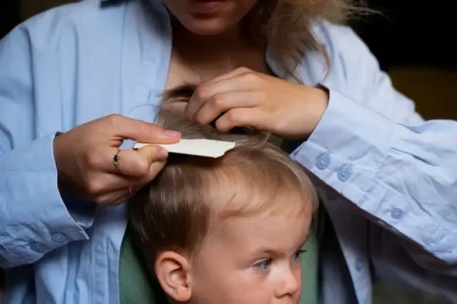 Mengenal Kutu Rambut, Pembuat Kepala Gatal Gak Karuan