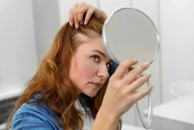 Rambut Rontok Tanda Seseorang Kekurangan Vitamin D