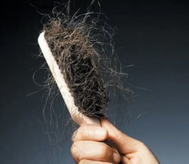 Rambut Sering Rontok? Coba Cara Ampuh Berikut untuk Mengatasinya
