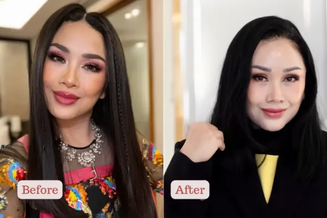 5 Fakta Perjalanan Titi DJ Jalani Operasi Anti Aging, Puas Sama Hasilnya