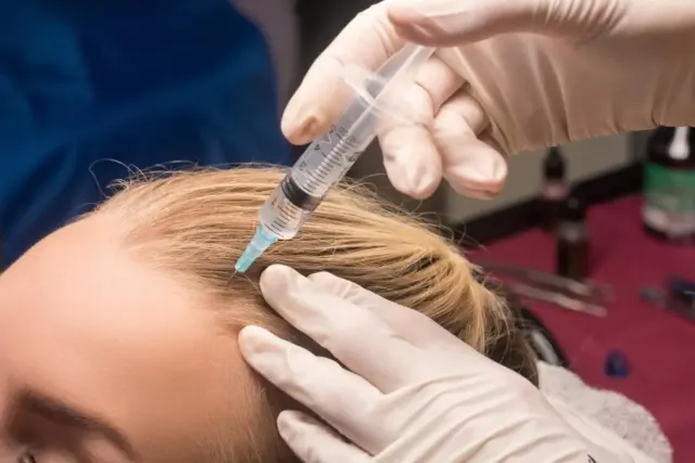 Treatment Botox Rambut Seberapa Efektif? Cek Manfaatnya