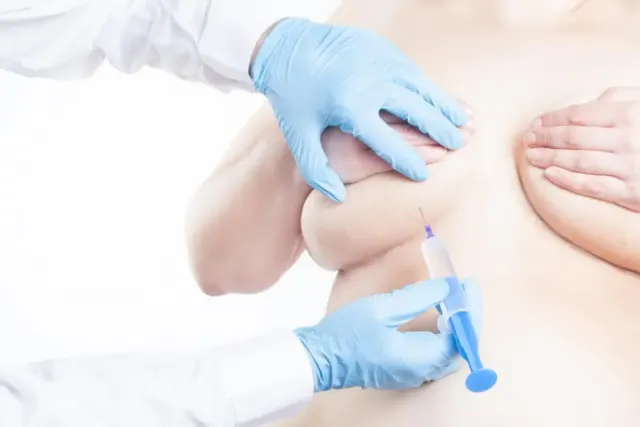 Amankah Percantik Payudara dengan Filler?