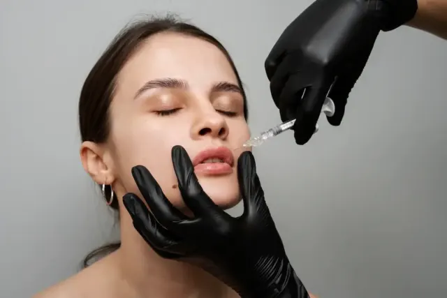 Kenali Jenis Suntik Filler, Buat yang Ingin Cantik Seperti Kylie Jenner