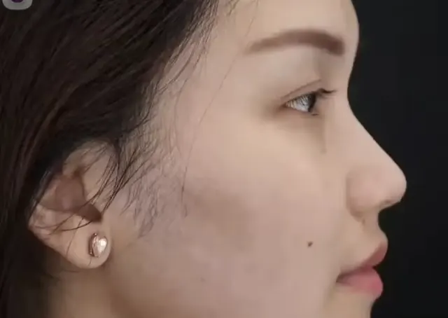 Ayu Ting Ting Pamer Hidung Baru untuk Lebaran, Netizen: Bersyukur Punya Hidung, Meski Pesek