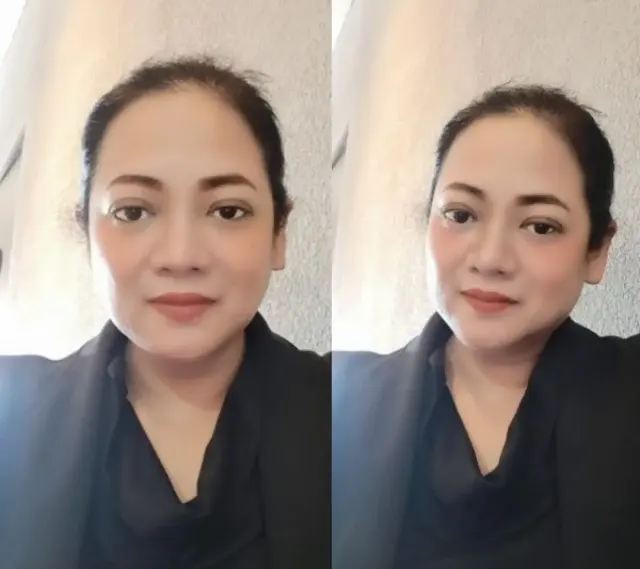 Cuaca Panas Ekstrem, Ini 7 Tips Praktis dari Ahli Unsoed untuk Perlindungan Kulit Maksimal