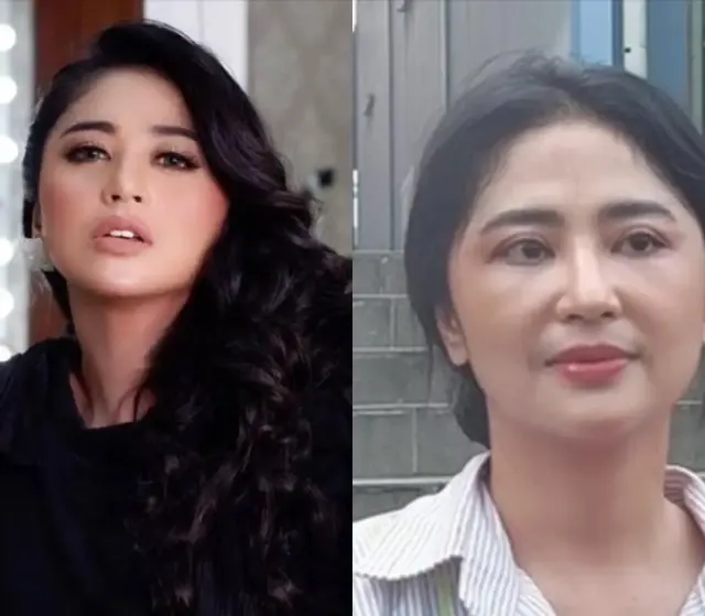 3 Fakta Menarik Operasi Mata Dewi Perssik, Persiapan untuk Menikah?
