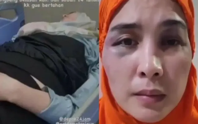 Diremas Putri Balqis, Kemaluan Bani Idham Luka Parah, Sampai Dioperasi