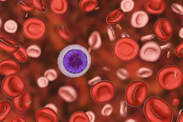 Apa Itu Thalasemia, Penyebab dan Cara Mencegahnya?