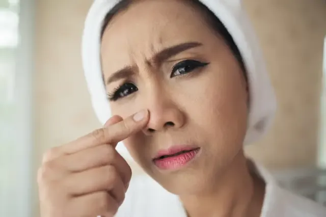 Komedo di Hidung: Penyebab dan Cara Mengatasinya