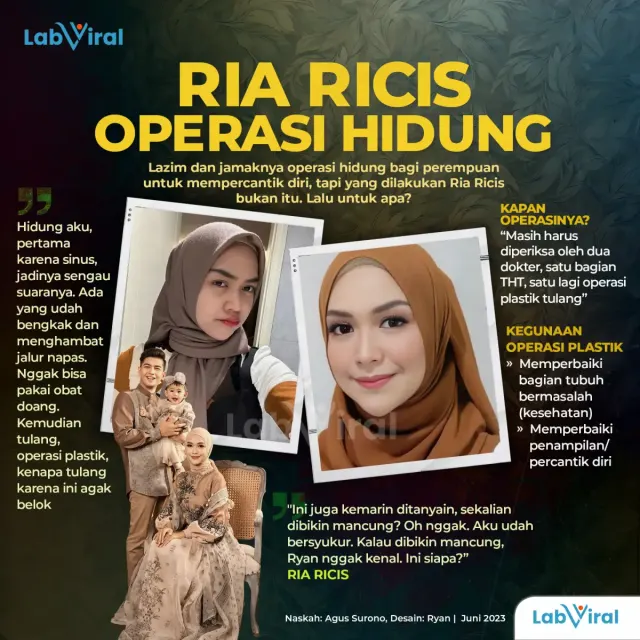 Ria Ricis Operasi Hidung