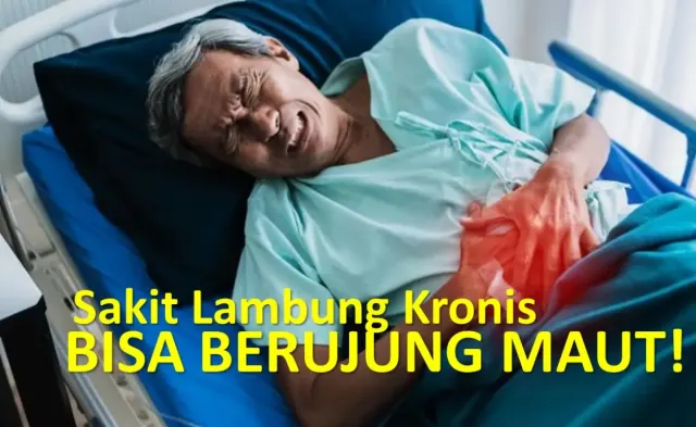 Begini Kondisi Sakit Lambung Kronis, Lengkap dengan Cara Pilih Obat Maag Paling Manjur Sebelum Urusan Makin Runyam
