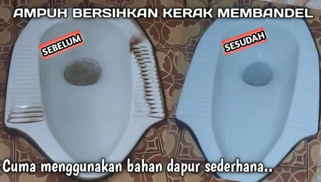 Cara Membersihkan Kloset Berkerak dengan Bahan Sederhana. Gampang Banget, Langsung Kinclong